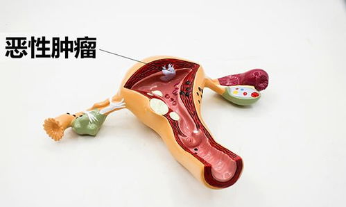 中宁汽车除甲醛价格多少 中宁汽车除甲醛价格多少
